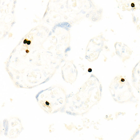 CD66b Antibody in Immunohistochemistry (Paraffin) (IHC (P))