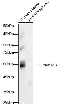 Human IgD Antibody in Western Blot (WB)