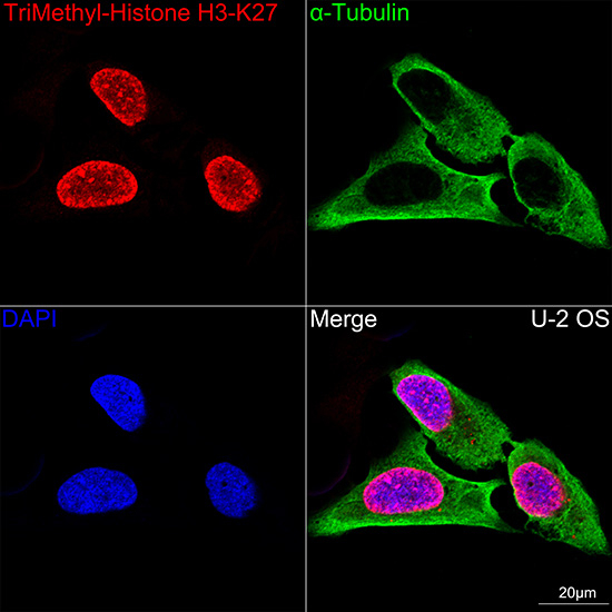 H3K27me3 Antibody in Immunocytochemistry (ICC/IF)
