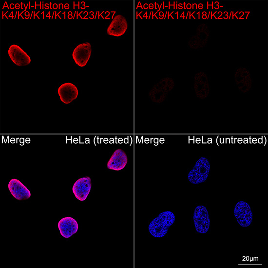 H3K9ac Antibody in Immunocytochemistry (ICC/IF)