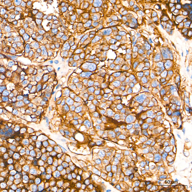 CD155 Antibody in Immunohistochemistry (Paraffin) (IHC (P))
