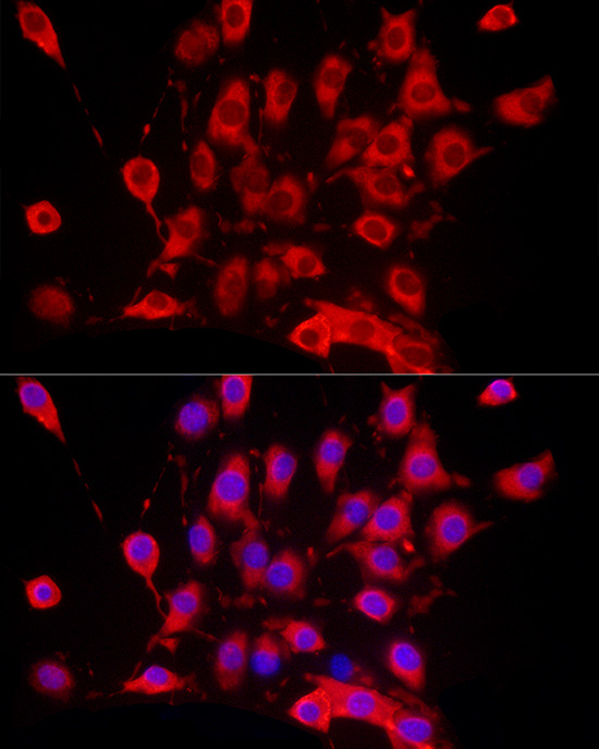 FASN Antibody in Immunocytochemistry (ICC/IF)