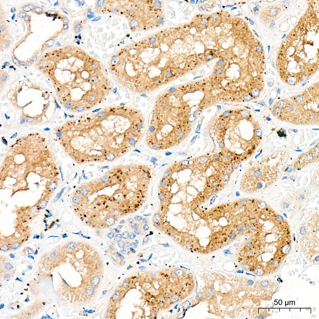 HEXA Antibody in Immunohistochemistry (Paraffin) (IHC (P))