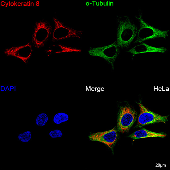 Cytokeratin 8 Antibody in Immunocytochemistry (ICC/IF)