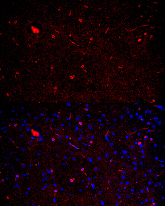 IBA1 Antibody in Immunohistochemistry (Paraffin) (IHC (P))