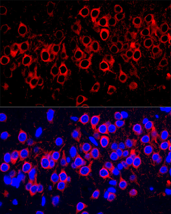 WFS1 Antibody in Immunohistochemistry (Paraffin) (IHC (P))