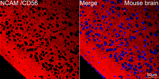 CD56 Antibody in Immunohistochemistry (Paraffin) (IHC (P))