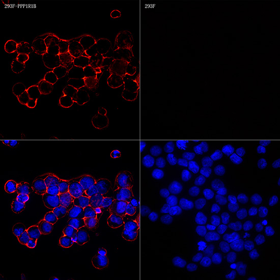 DARPP-32 Antibody in Immunocytochemistry (ICC/IF)