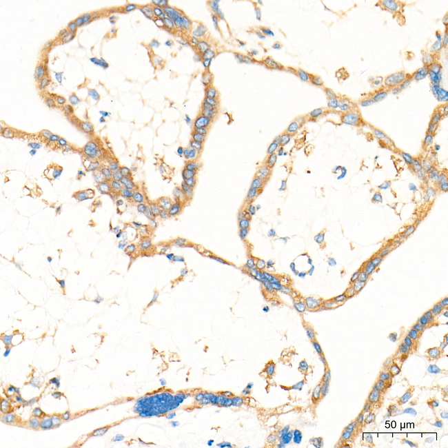 Dicer Antibody in Immunohistochemistry (Paraffin) (IHC (P))