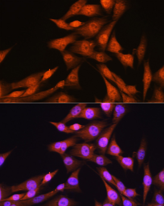 SMAD1 Antibody in Immunocytochemistry (ICC/IF)