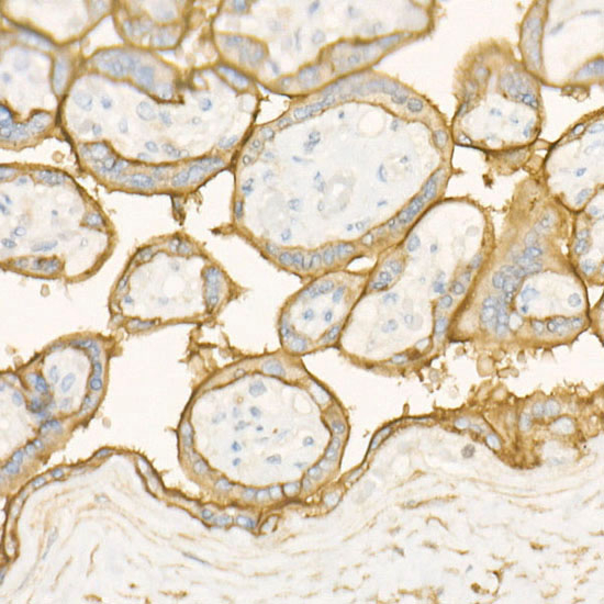 CD10 Antibody in Immunohistochemistry (Paraffin) (IHC (P))