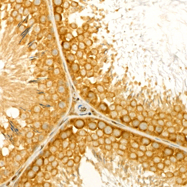 BCL-XL Antibody in Immunohistochemistry (Paraffin) (IHC (P))