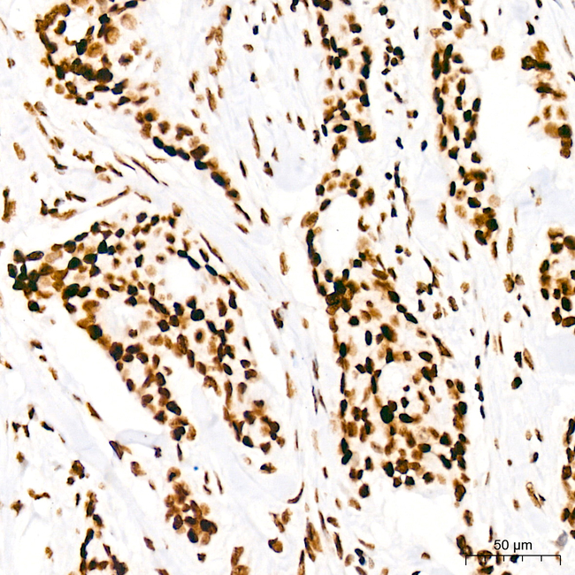 H4K5ac Antibody in Immunohistochemistry (Paraffin) (IHC (P))