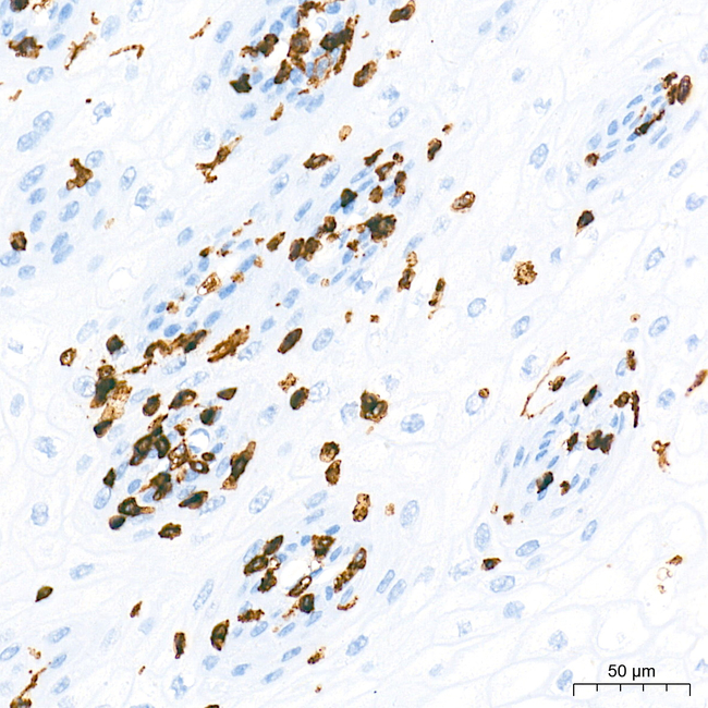 CD45 Antibody in Immunohistochemistry (Paraffin) (IHC (P))