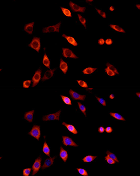 DVL2 Antibody in Immunocytochemistry (ICC/IF)
