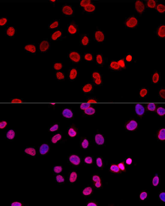 H3K27me3 Antibody in Immunocytochemistry (ICC/IF)