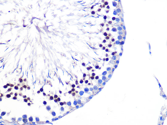 AKT Pan Antibody in Immunohistochemistry (Paraffin) (IHC (P))