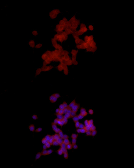 PGP9.5 Antibody in Immunocytochemistry (ICC/IF)