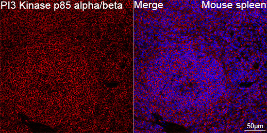 PI3 Kinase p85 alpha/beta Antibody in Immunohistochemistry (Paraffin) (IHC (P))