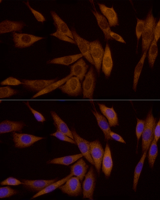 Galectin 3 Antibody in Immunocytochemistry (ICC/IF)