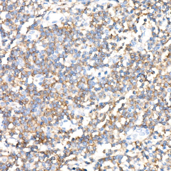Ly-108 Antibody in Immunohistochemistry (Paraffin) (IHC (P))