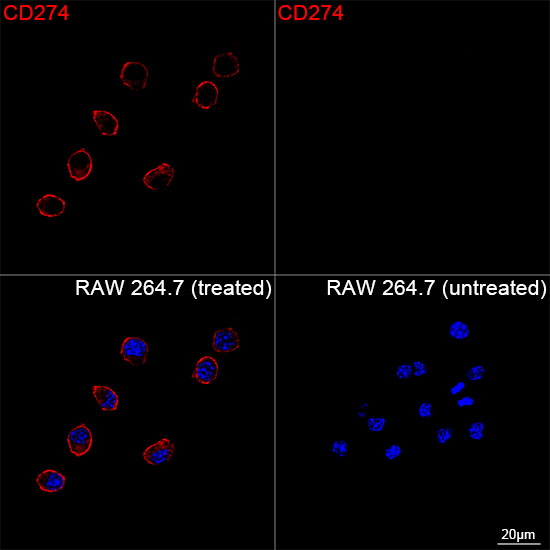 PD-L1 Antibody in Immunocytochemistry (ICC/IF)