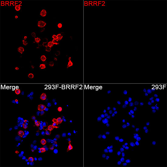 Epstein Barr Virus BRRF2 Antibody in Immunocytochemistry (ICC/IF)