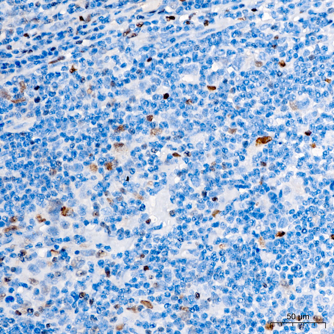 T-bet Antibody in Immunohistochemistry (Paraffin) (IHC (P))