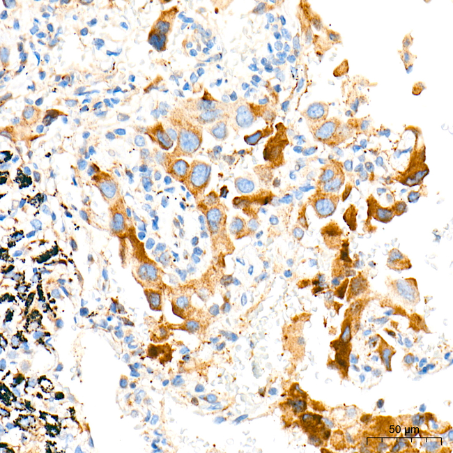 RAB5A Antibody in Immunohistochemistry (Paraffin) (IHC (P))