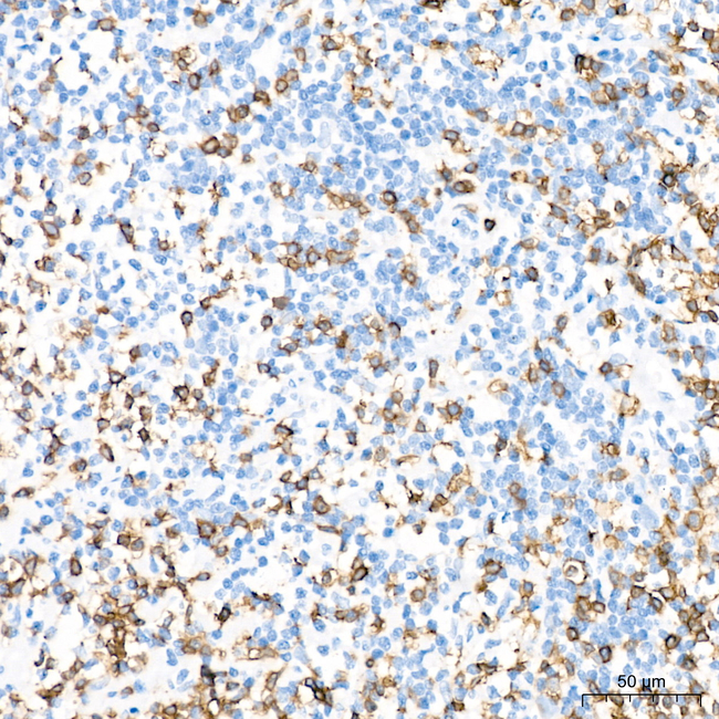 CD3 Antibody in Immunohistochemistry (Paraffin) (IHC (P))