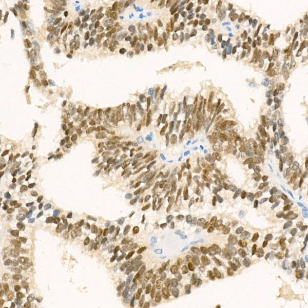 Nkx3.1 Antibody in Immunohistochemistry (Paraffin) (IHC (P))