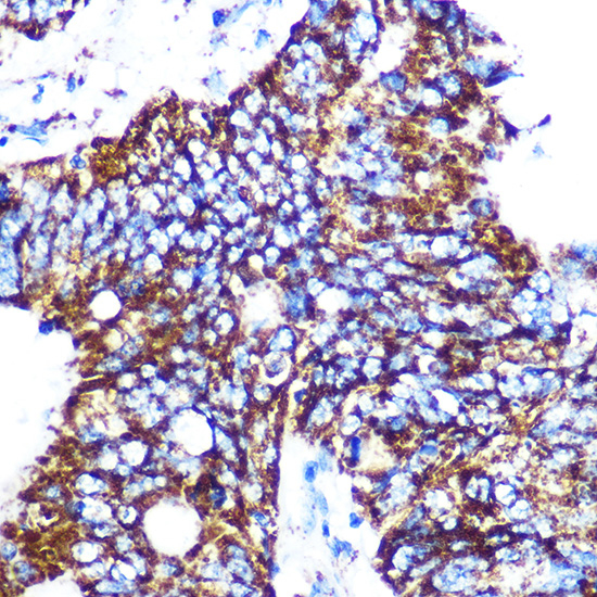 C1QBP Antibody in Immunohistochemistry (Paraffin) (IHC (P))