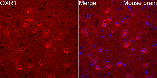 OXR1 Antibody in Immunohistochemistry (Paraffin) (IHC (P))