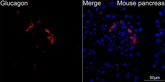 Glucagon Antibody in Immunohistochemistry (Paraffin) (IHC (P))