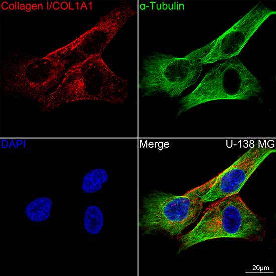 COL1A1 Antibody in Immunocytochemistry (ICC/IF)