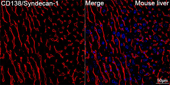 CD138 Antibody in Immunohistochemistry (Paraffin) (IHC (P))