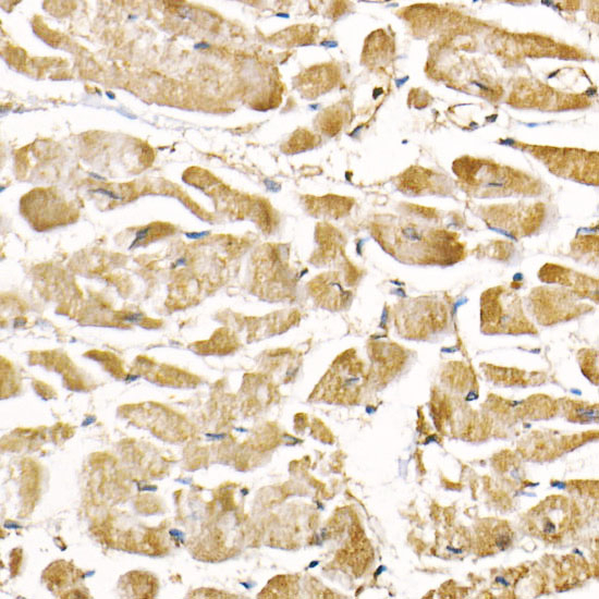 RAB7A Antibody in Immunohistochemistry (Paraffin) (IHC (P))