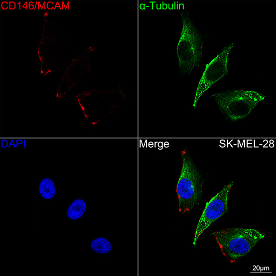 CD146 Antibody in Immunocytochemistry (ICC/IF)
