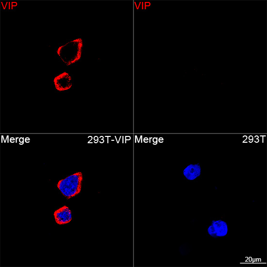 VIP Antibody in Immunocytochemistry (ICC/IF)
