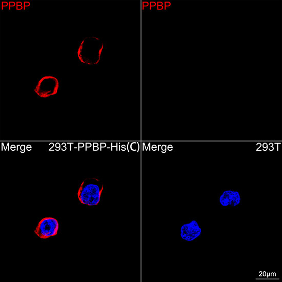 PPBP Antibody in Immunocytochemistry (ICC/IF)