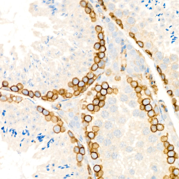 CD146 Antibody in Immunohistochemistry (Paraffin) (IHC (P))