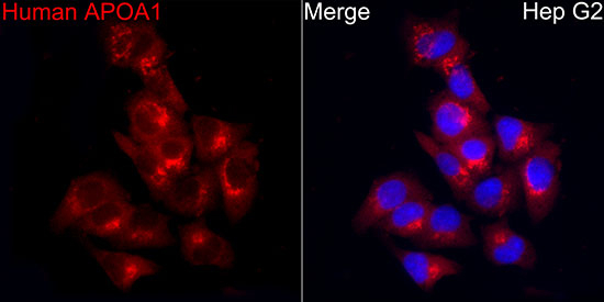 ApoA1 Antibody in Immunocytochemistry (ICC/IF)