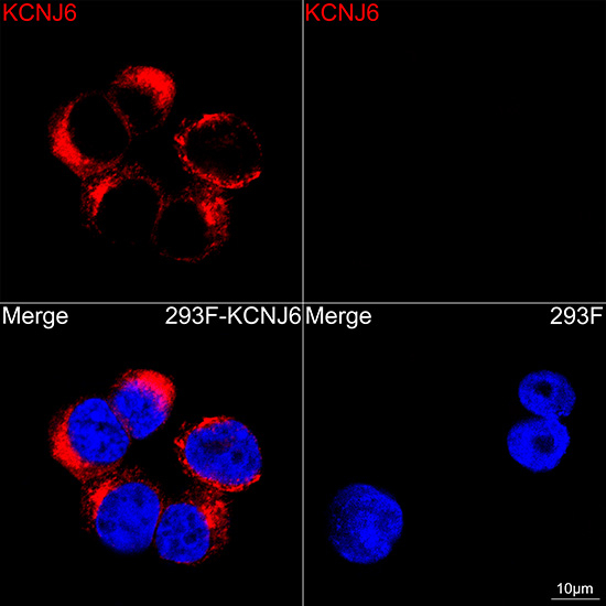 Kir3.2 (KCNJ6) Antibody in Immunocytochemistry (ICC/IF)