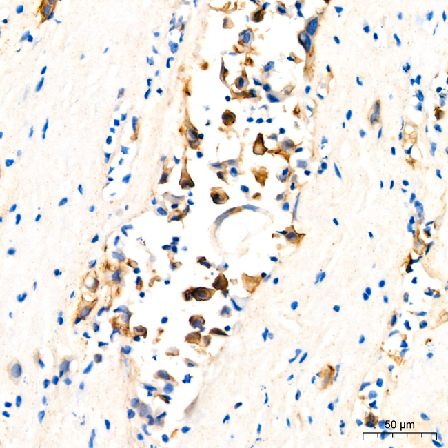 Mesothelin Antibody in Immunohistochemistry (Paraffin) (IHC (P))