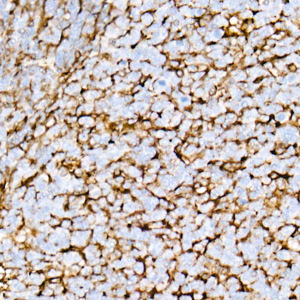STING Antibody in Immunohistochemistry (Paraffin) (IHC (P))