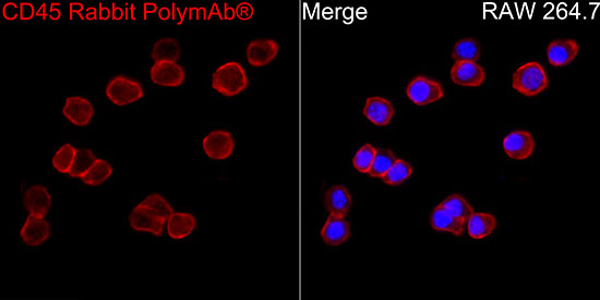 CD45 Antibody in Immunocytochemistry (ICC/IF)
