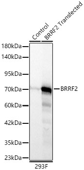 Epstein Barr Virus BRRF2 Antibody in Western Blot (WB)