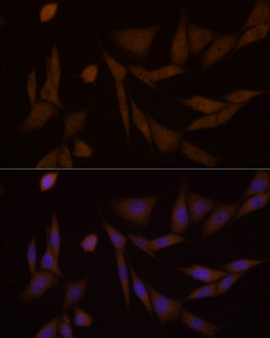 PFKFB3 Antibody in Immunocytochemistry (ICC/IF)