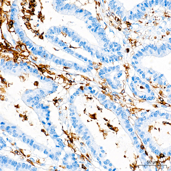CD45 Antibody in Immunohistochemistry (Paraffin) (IHC (P))