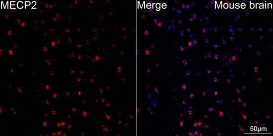 MECP2 Antibody in Immunohistochemistry (Paraffin) (IHC (P))
